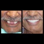 A man with white teeth and black mustache.
