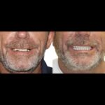 A man with gray hair and no teeth is smiling.