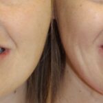 A woman with and without makeup on.