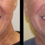 A man with no teeth and without his smile.