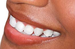 Preventive Dentistry The Villages