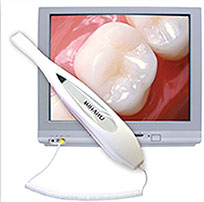 Intra Oral Dental Camera The Villages FL